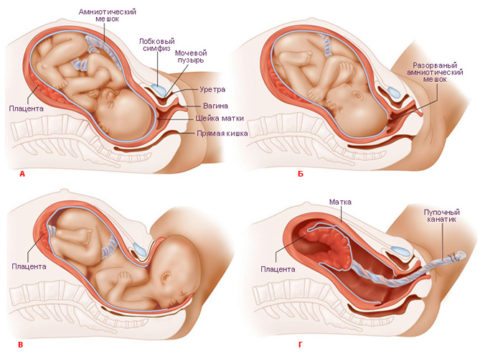 Как понять что скоро рожаешь - Первые признаки наступления родов у женщины